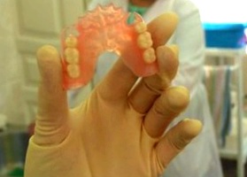 зубные протезы цены