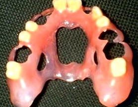 зубной нейлоновый протез