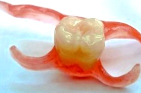 зубной нейлоновый протез